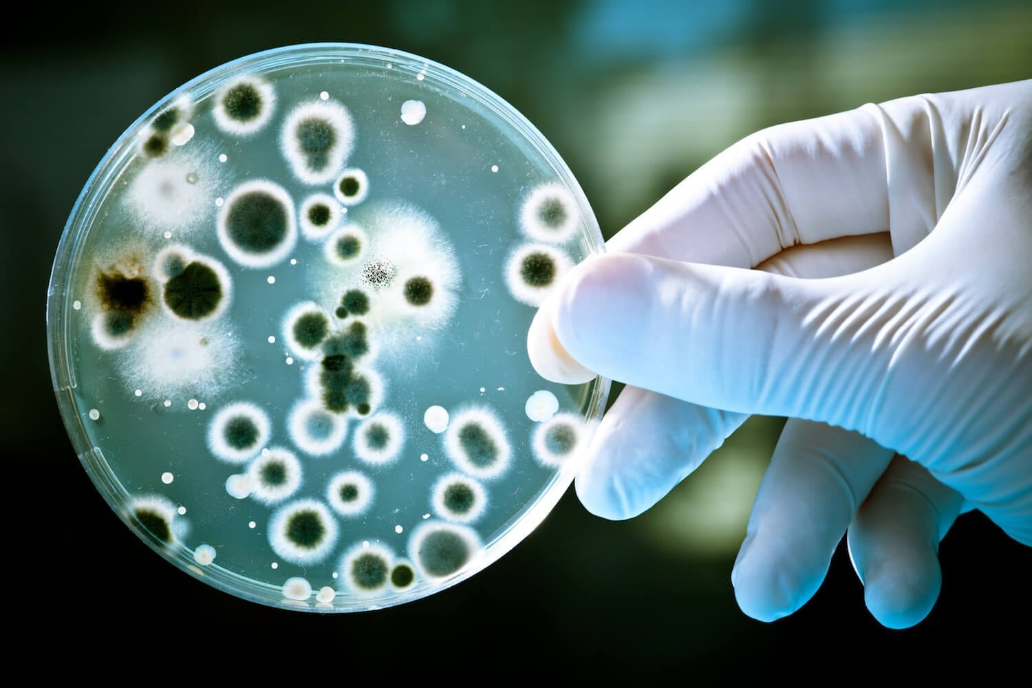Viruses & Bacteria Viruses & Bacteria